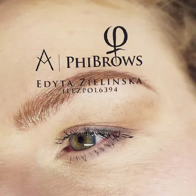 Edyta Zielińska Centrum Pielęgnacji Skóry Plasma Pen